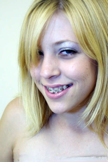 appareil dentaire pour adolescents xxx jolie img