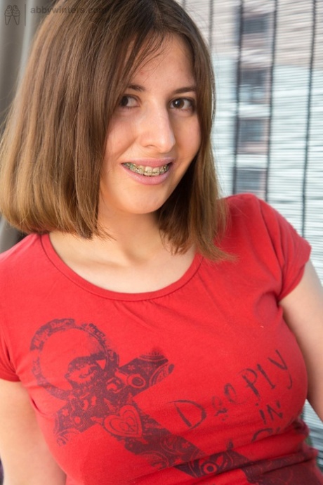 teen braces nice galleries