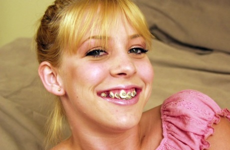 teen braces pretty pic