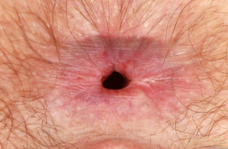 close up anal naked pic