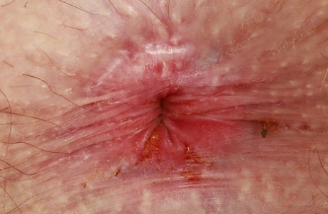 kontgat van dichtbij sexy hd verzameling