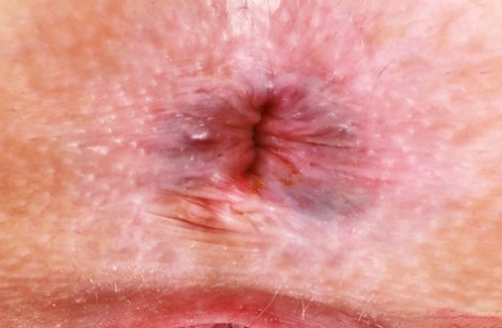 asshole close up art nude galleries