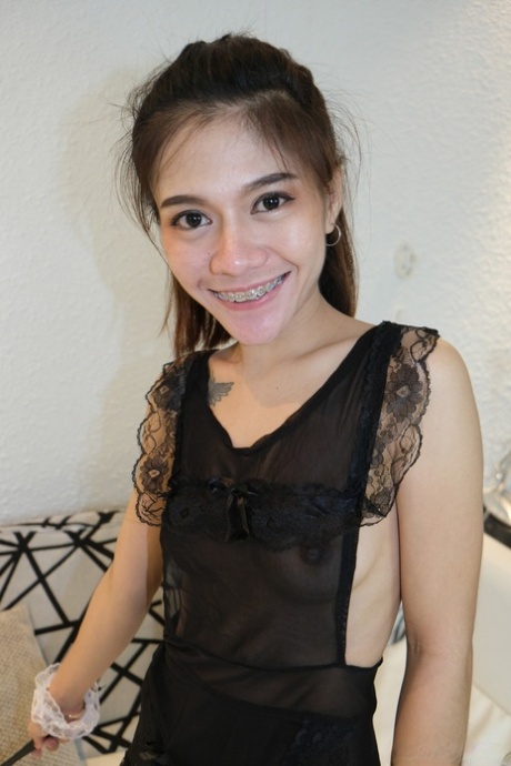 teen braces free naked photo