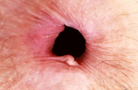 infermiera anale nudo hd immagini