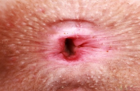 teen anal gape beautiful porn images