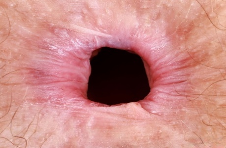 anal gape erotic photo