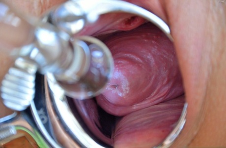 gynekolog xxx nahá archiv